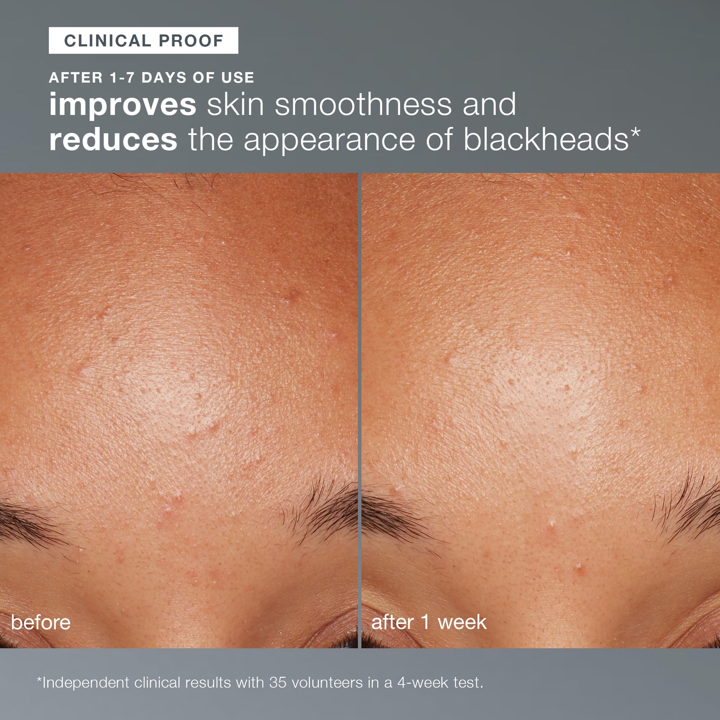 Daily Microfoliant®