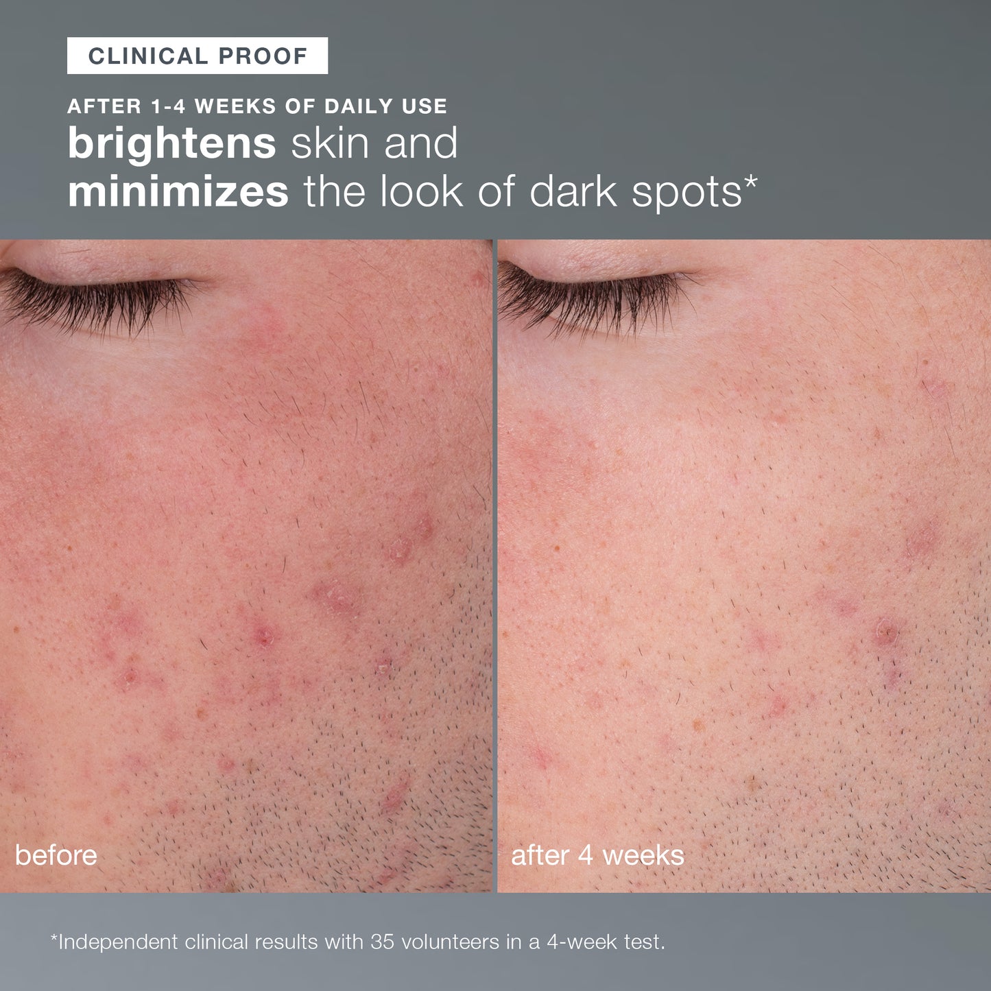 Daily Microfoliant®