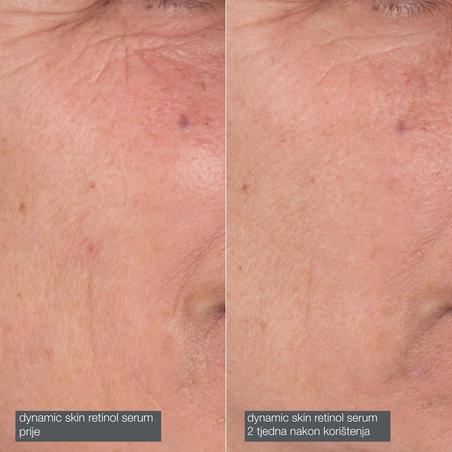 Skin Ageing Solutions Kit