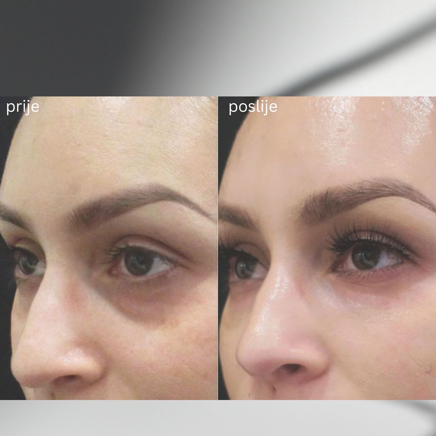 AQUAGOLD® fine touch™