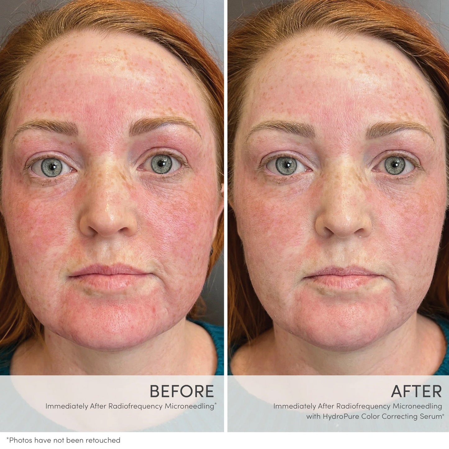 HydroPure Color Correcting Serum