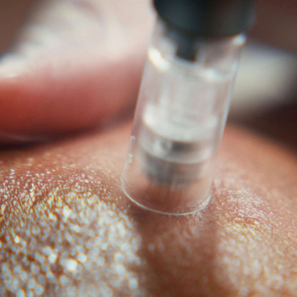 Hormonal Reset Ritual